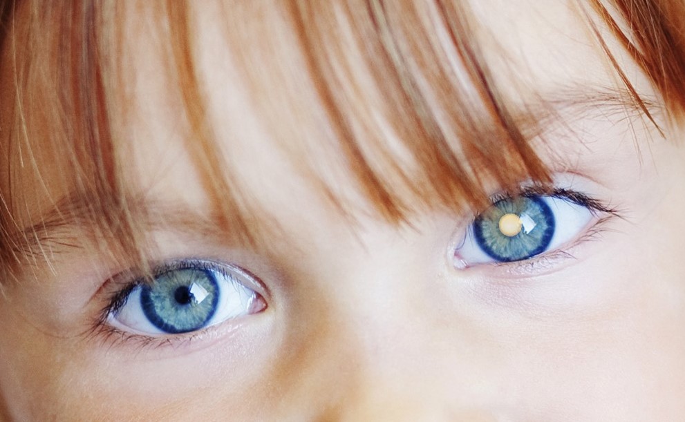 Weiss sehen - Früherkennung von Augenkrebs bei Kindern